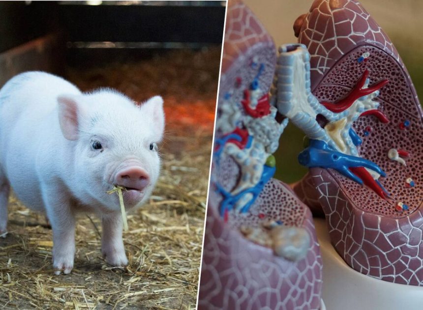 El primer ser humano con un pulmón de cerdo ya existe: es el inicio de una gran revolución en los trasplantes